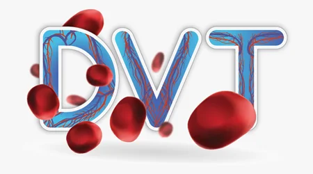 لخته خون در پا