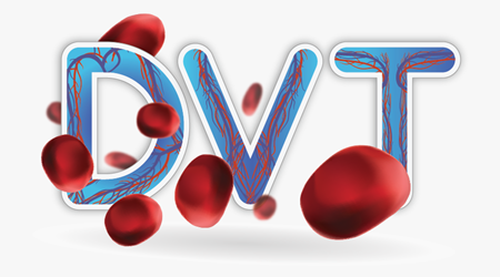 لخته خون در عروق عمقی 🔗