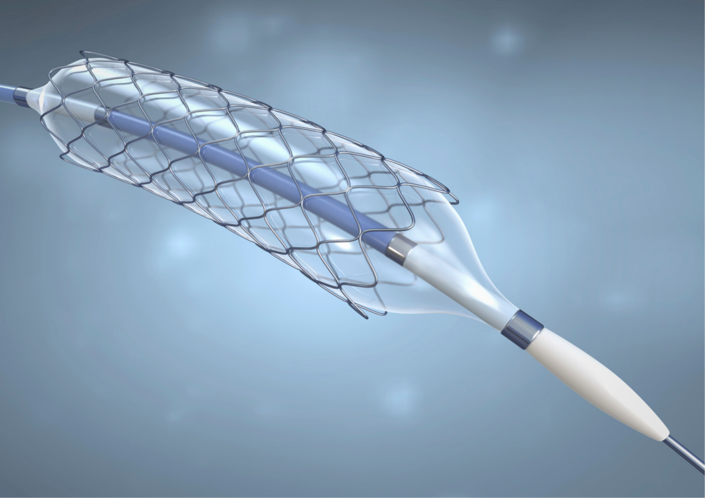 استنت و بالون قلب