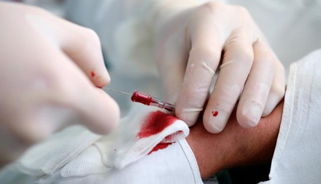 آنژیوگرافی و پلاستی