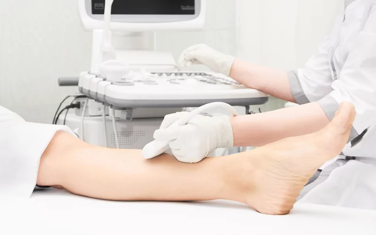 سونوگرافی عروق دست و پا