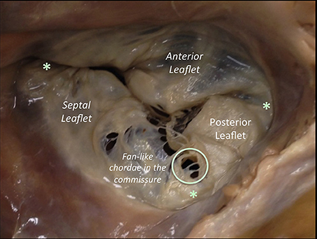 دریچه تریکوسپید 🔗
