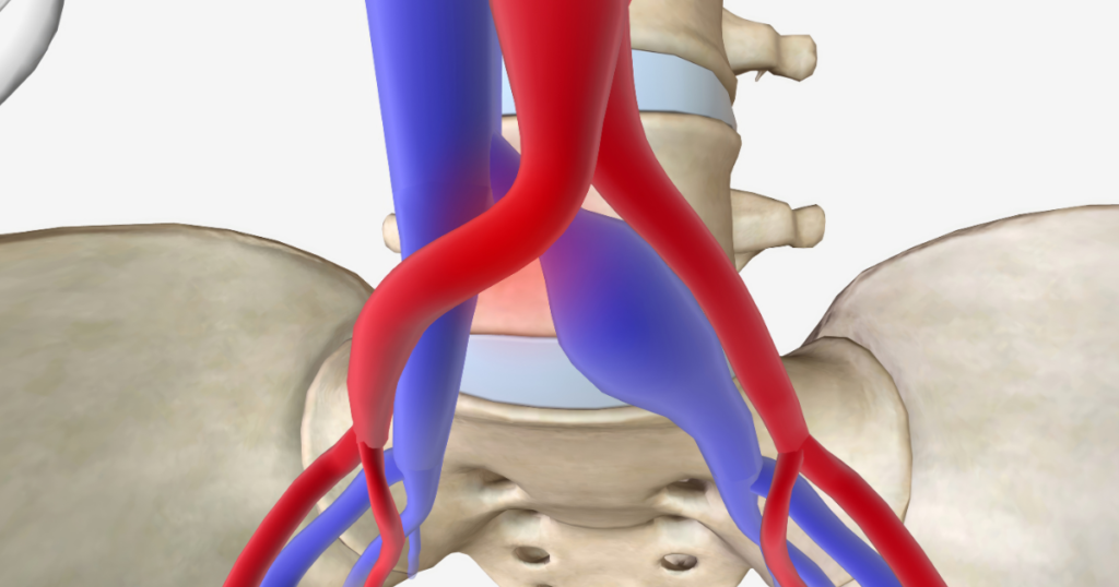 سندروم «می ترنر» چیست؟